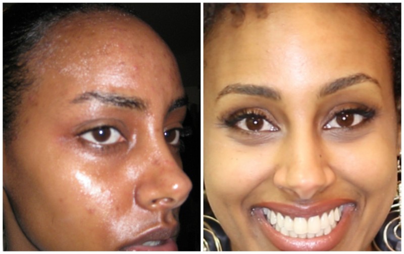 Get your desired results with the safest skin care products Rollyhampy +27760829927