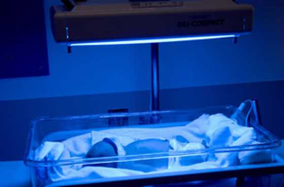 Phototherapy Light and Bili bed for jaundice in new born treatment.