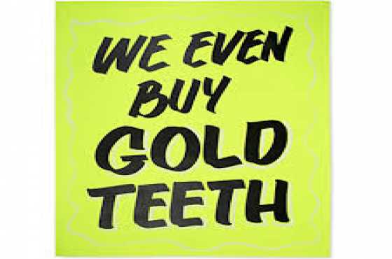 We even buy gold teeth