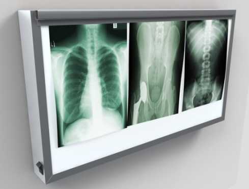 X-Ray Viewing Box - 3 Pane