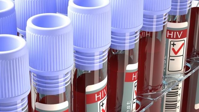 HIV Medicines, HIV Cure, HIV Treatment +27639190421