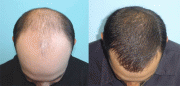 Hair Grow Products for sale in Pretoria ((( 0730088135 )))