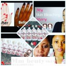 Skin Tone On knuckles @ Knees Whatsapp Modeelo 0785009705 South Africa We deliver